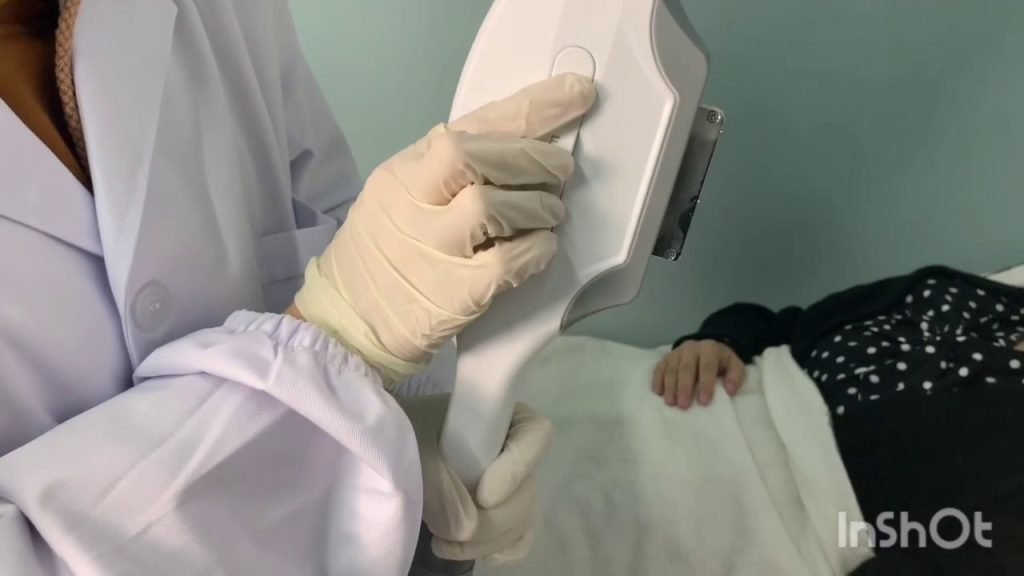 Beauty Machine Online Training 32 3 3 hair removal by super shr mo