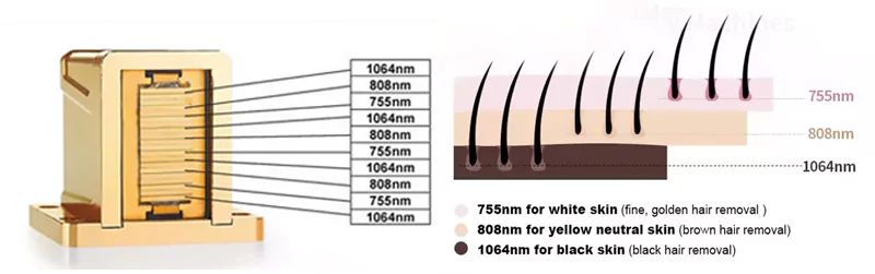 The Best Machine for Laser Hair Removal: 1200W Diode Laser 3 Wavelengths 2 3 WAVE DIODE LASER