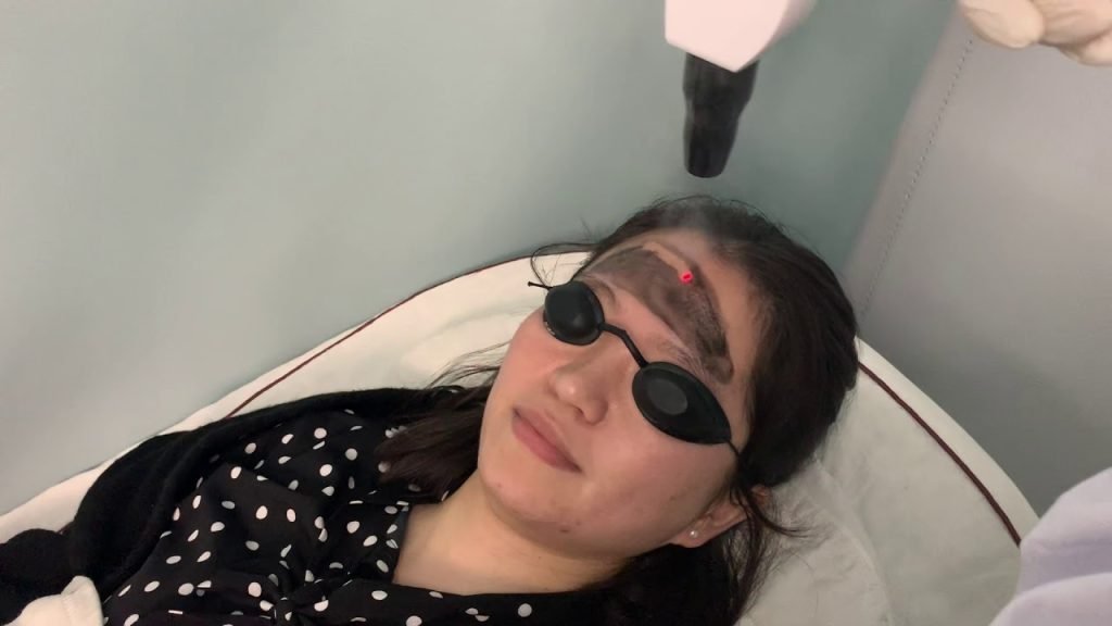 Beauty Machine Online Training 30 4 2 carbon peeling hollywood pee