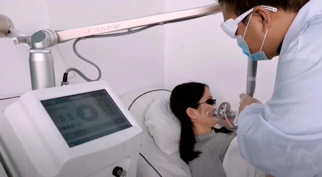 Medspa Classic Treatment - Carbon Dioxide Fractional Laser 9 Carbon Dioxide Fractional Laser in skin resurfacing