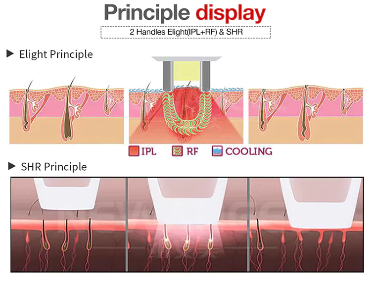 IPL SHR OPT Hair Removal Salon Machine 40 IPL SHR OPT working theroy 3