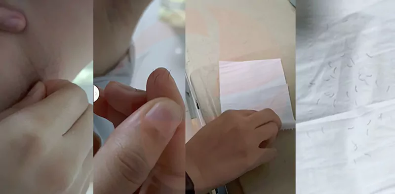 Fat Freeze Cryolipolysis Machine for Sale 20 Laser Hair Removal effect