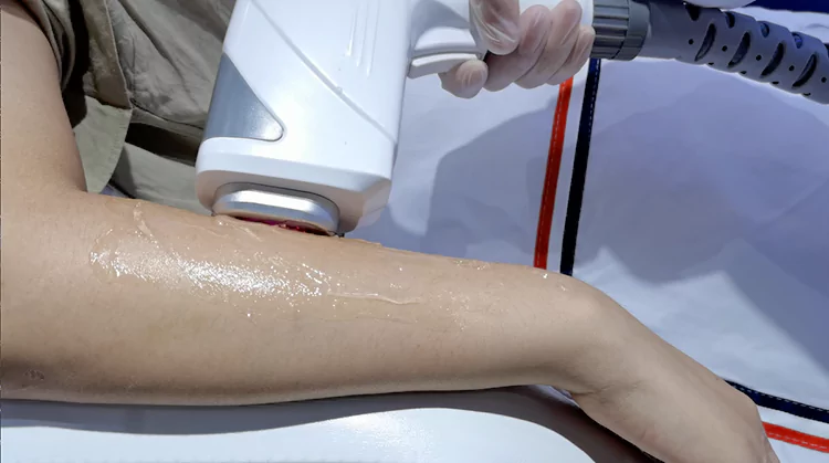 808 Diode Laser Hair Removal Machine 20 big tip for large area hair removal