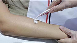 Hair Removal Treatment 7 diode laser hair removal steps 1