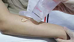 Hair Removal Treatment 8 diode laser hair removal steps 2