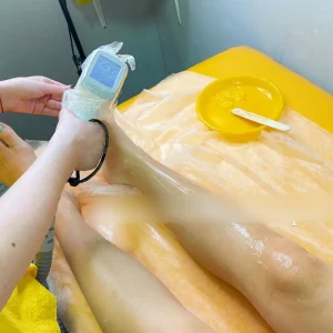 Testimonial 9 latest-hair-removal-diode-laser-feedback-6.webp