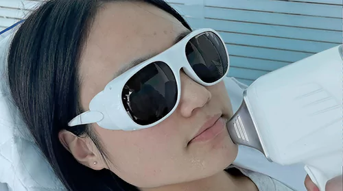 New Smart Diode Laser Hair Removal Machine 808nm 15 facial hair removal by diode laser