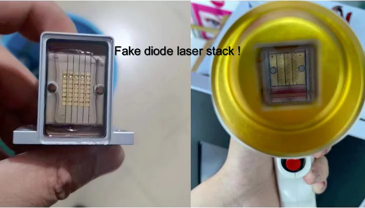 4 Scams You May Meet in Buying Laser Beauty Machines 10 fake diode laser hair removal machine