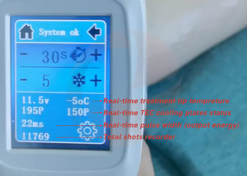 How Does It Feel for Laser Hair Removal by Diode Laser Machine 3 fantastic diode machine monitoring system