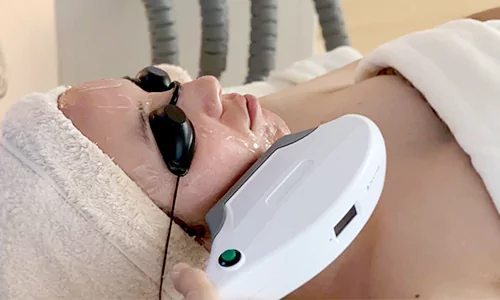 980 nm Diode Laser Vascular Removal Machine for Sale 32 ipl photofacial