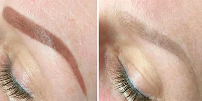 4 in 1 Laser Multifunctional Beauty Machine Diode ND Yag Elos RF 31 Eyebrow tattoo removal