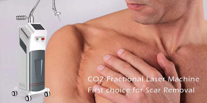 Fat Freeze Cryolipolysis Machine for Sale 21 scar removal machine co2 laser